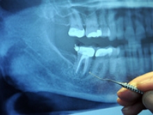 Medical Malpractice Attorney in Rochester NY